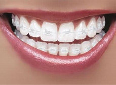 El mejor presupuesto de ortodoncia lo encontrarás en nuestra clínica dental Virginia Salvador